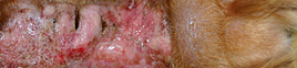 Granuloma acral por lamido