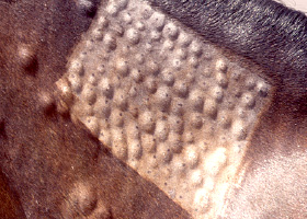 Photo of Habón (urticaria)